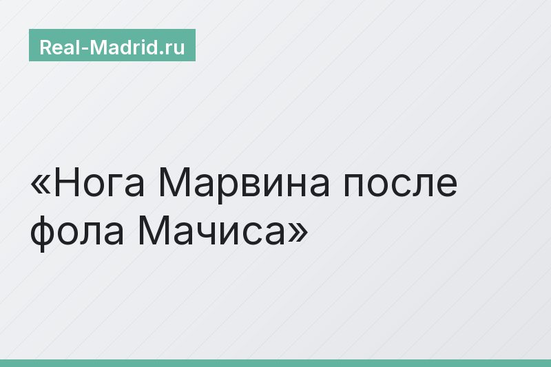 Нога Марвина после фола Мачиса